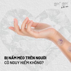 Bị nấm mèo cần làm gì? Cách điều trị nấm mèo ở người