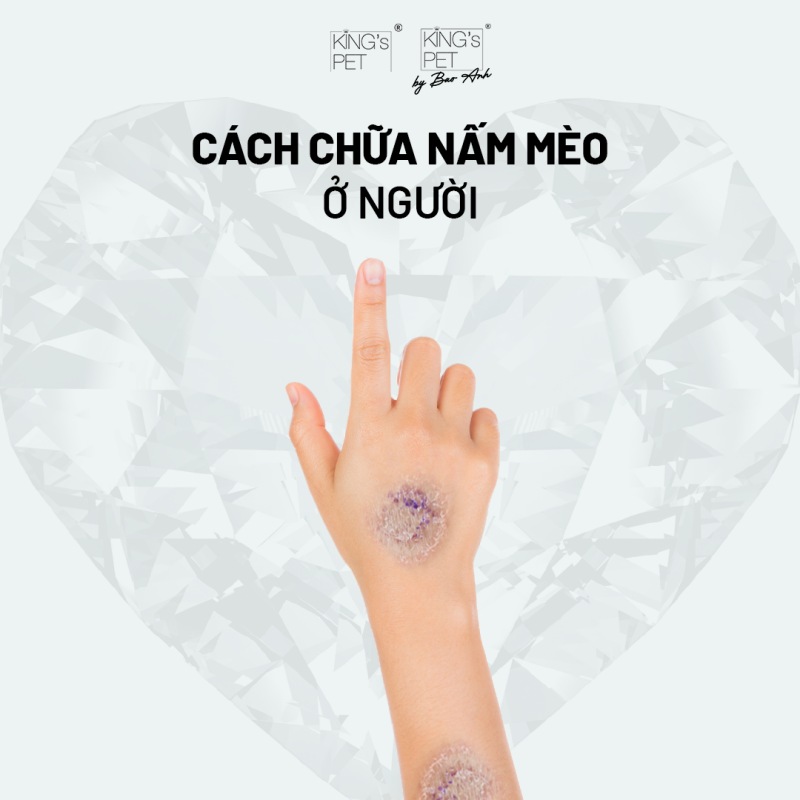 Nấm mèo trên người